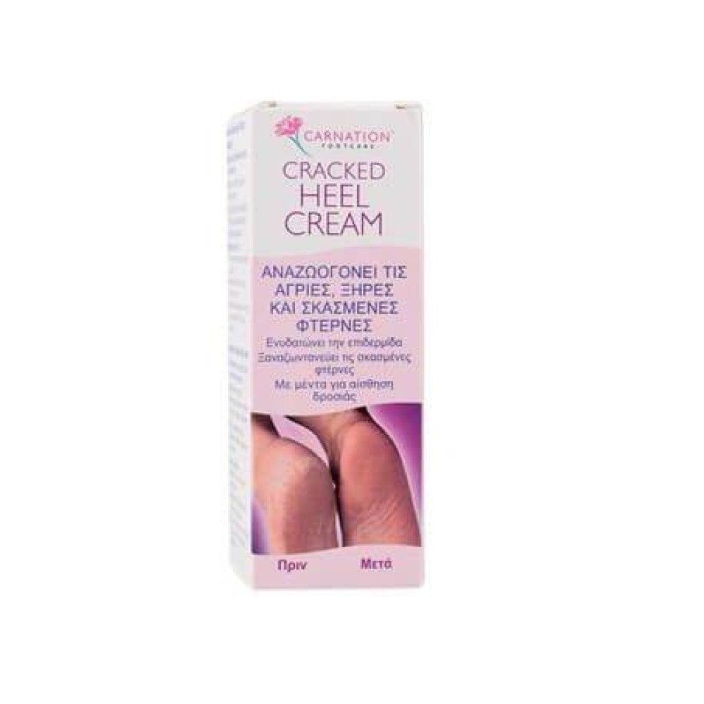 Carnation Cracked Heel Cream | Κρέμα για Σκασμένες Φτέρνες | 50ml