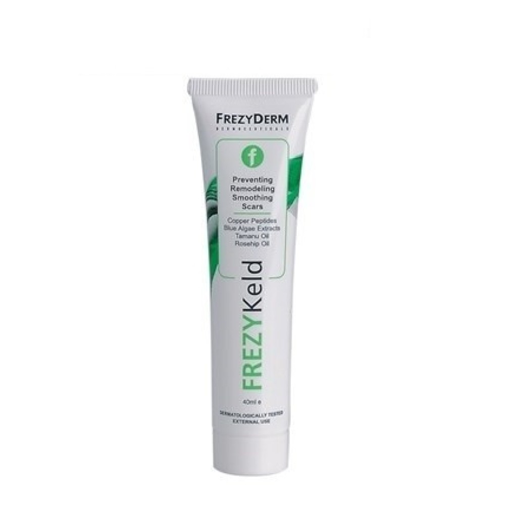 Frezyderm | Frezykeld Cream|Κρέμα Πρόληψης Βελτίωσης Λείανσης Ουλών | 40ml